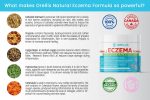 ECZEMA FORMULE 100G ORELLIS on Sale