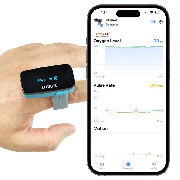 LOOKEE® Ring Sleep Oxygen Monitor with Vibration Reminder for Low O2 | Continuous Ring Pulse Oximeter Tracks Blood Oxygen Level and Heart Rate Discount