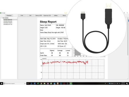 Professional Version Upgrade Package for LOOKEE® Ring Sleep Monitor, Including PC Software and PC Data Cable Online Sale