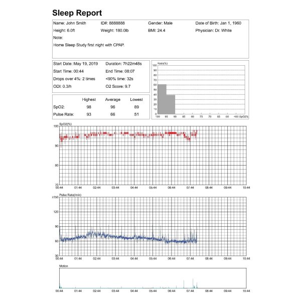 Professional Version Upgrade Package for LOOKEE® Ring Sleep Monitor, Including PC Software and PC Data Cable Online Sale